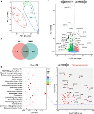 Specific gene expression signatures of low grade meningiomas